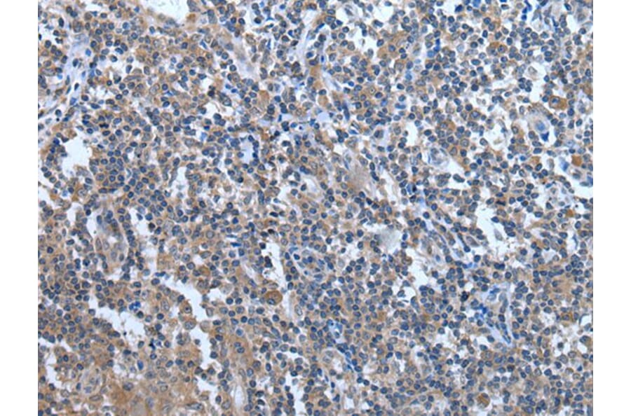 WDR11 Antibody from Signalway Antibody (43976) - Antibodies.com