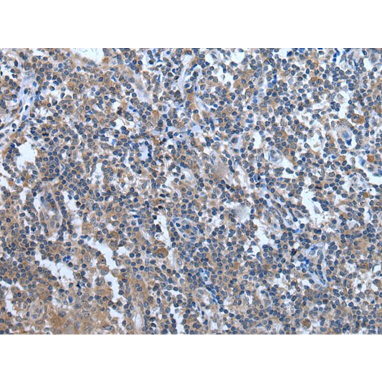 WDR11 Antibody from Signalway Antibody (43976) - Antibodies.com