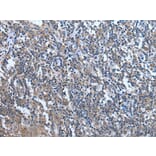 WDR11 Antibody from Signalway Antibody (43976) - Antibodies.com