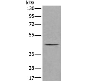VPS36 Antibody from Signalway Antibody (43983) - Antibodies.com
