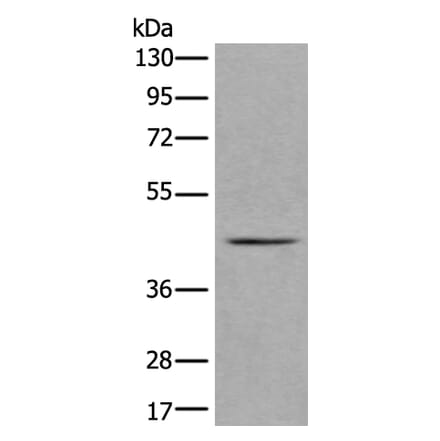 VPS36 Antibody from Signalway Antibody (43983) - Antibodies.com