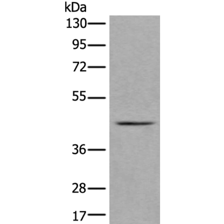 VPS36 Antibody from Signalway Antibody (43983) - Antibodies.com