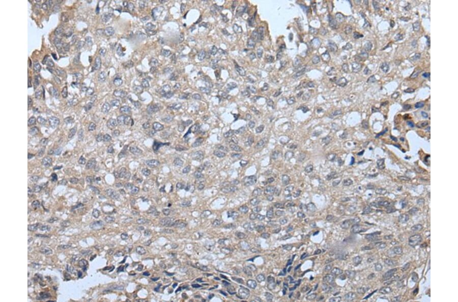 VPS36 Antibody from Signalway Antibody (43983) - Antibodies.com