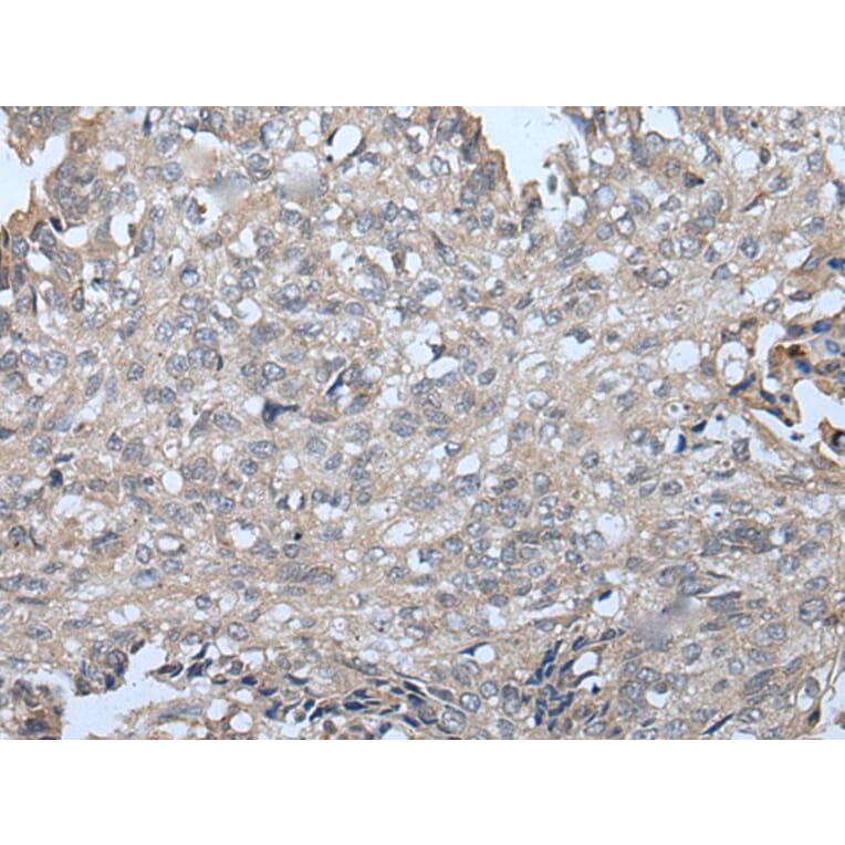 VPS36 Antibody from Signalway Antibody (43983) - Antibodies.com