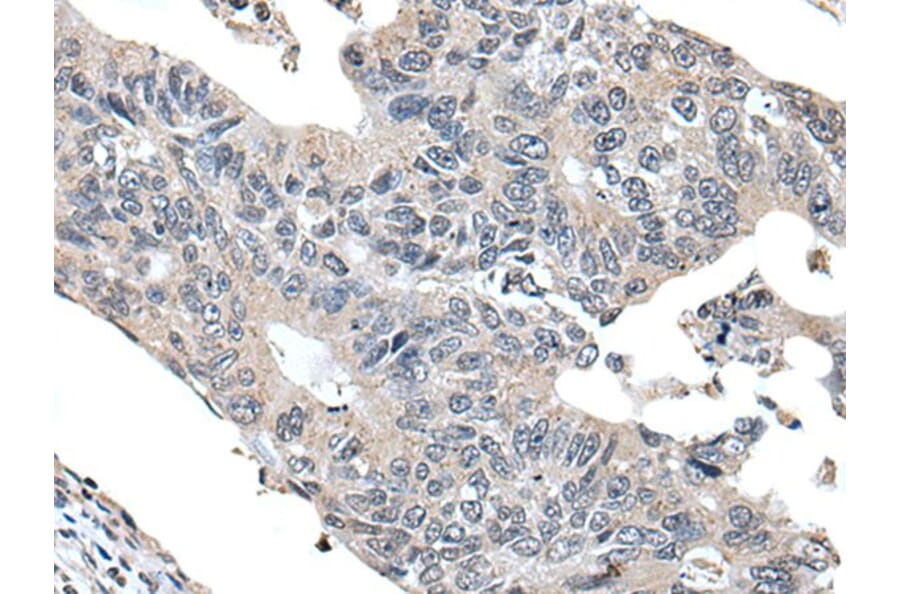 VPS36 Antibody from Signalway Antibody (43983) - Antibodies.com