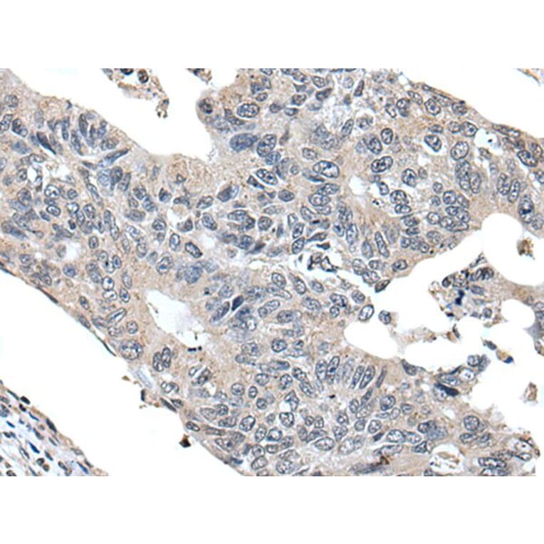 VPS36 Antibody from Signalway Antibody (43983) - Antibodies.com