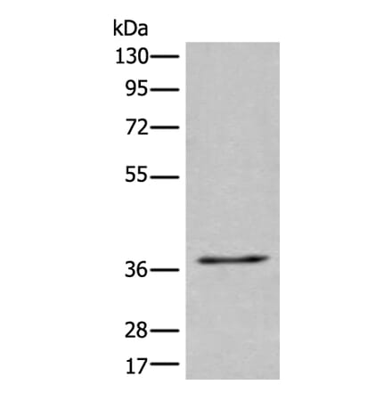 UBAC2 Antibody from Signalway Antibody (43984) - Antibodies.com
