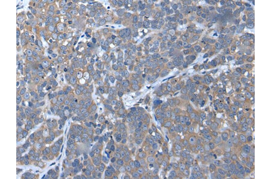 UBAC2 Antibody from Signalway Antibody (43984) - Antibodies.com