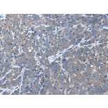 UBAC2 Antibody from Signalway Antibody (43984) - Antibodies.com