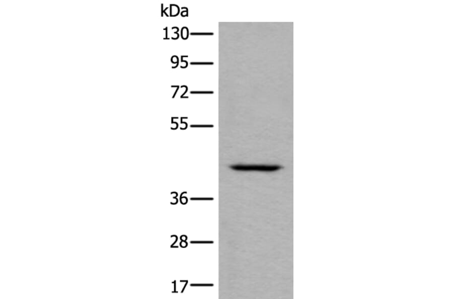 DSCC1 Antibody from Signalway Antibody (43987) - Antibodies.com