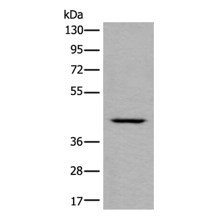 DSCC1 Antibody from Signalway Antibody (43987) - Antibodies.com