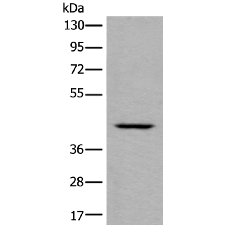 DSCC1 Antibody from Signalway Antibody (43987) - Antibodies.com