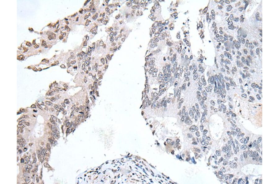 DSCC1 Antibody from Signalway Antibody (43987) - Antibodies.com