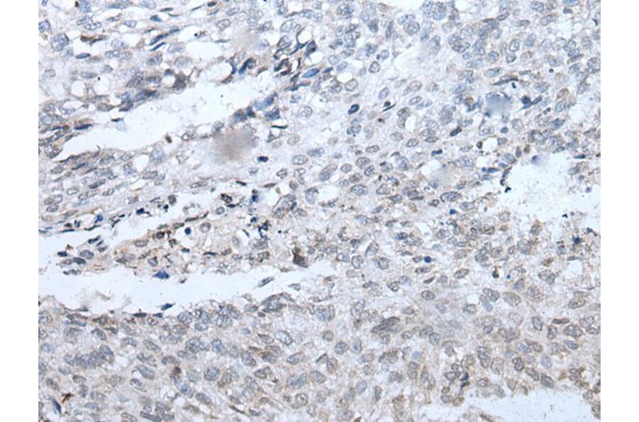 DSCC1 Antibody from Signalway Antibody (43987) - Antibodies.com