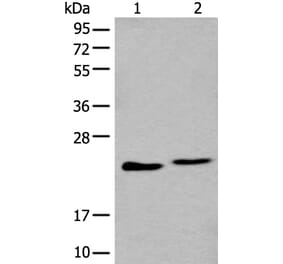 BLVRB Antibody from Signalway Antibody (43993) - Antibodies.com