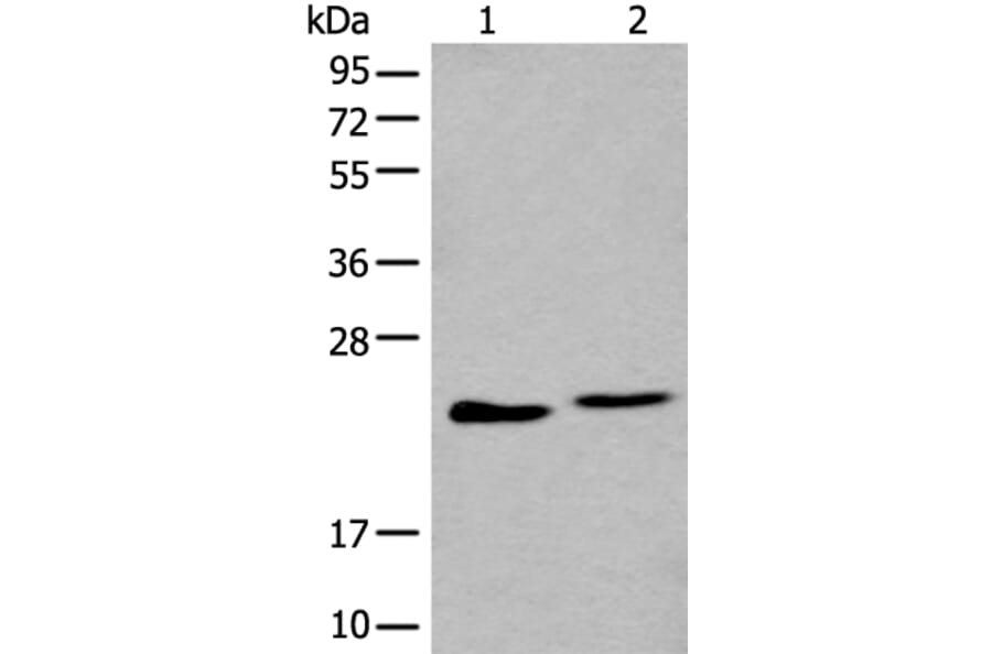 BLVRB Antibody from Signalway Antibody (43993) - Antibodies.com