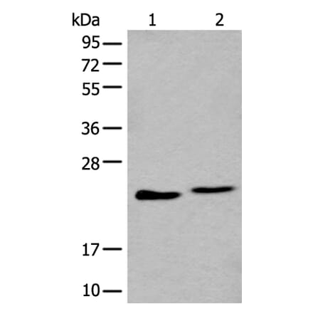 BLVRB Antibody from Signalway Antibody (43993) - Antibodies.com
