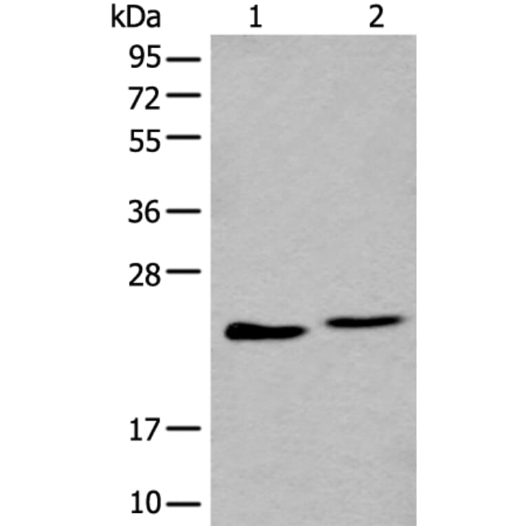 BLVRB Antibody from Signalway Antibody (43993) - Antibodies.com