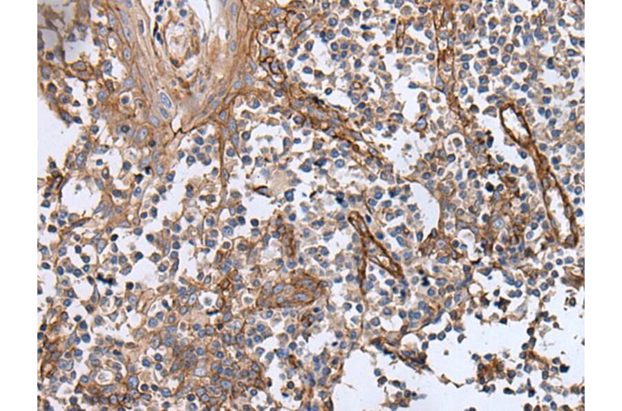 BLVRB Antibody from Signalway Antibody (43993) - Antibodies.com