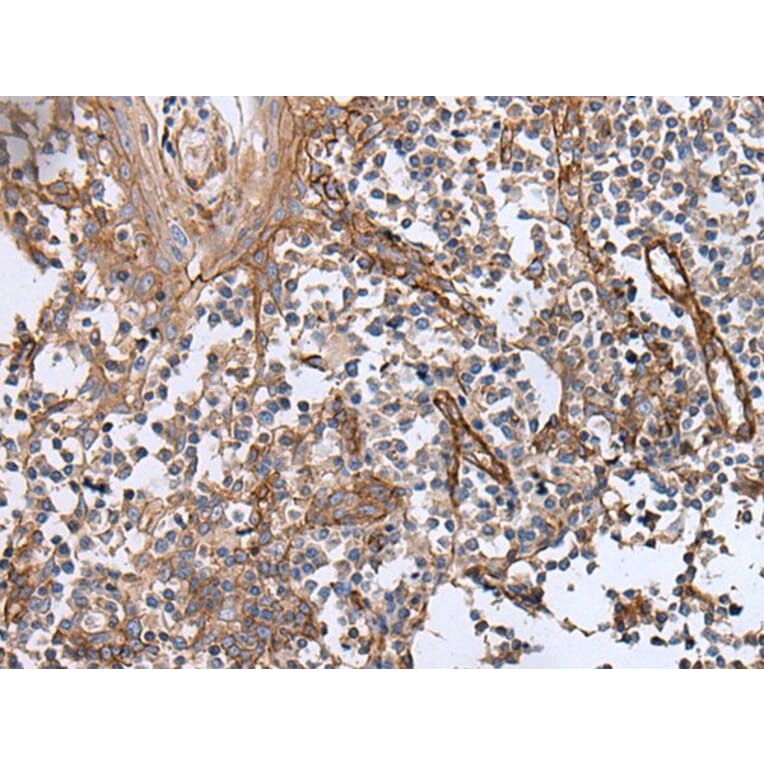 BLVRB Antibody from Signalway Antibody (43993) - Antibodies.com