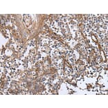 BLVRB Antibody from Signalway Antibody (43993) - Antibodies.com