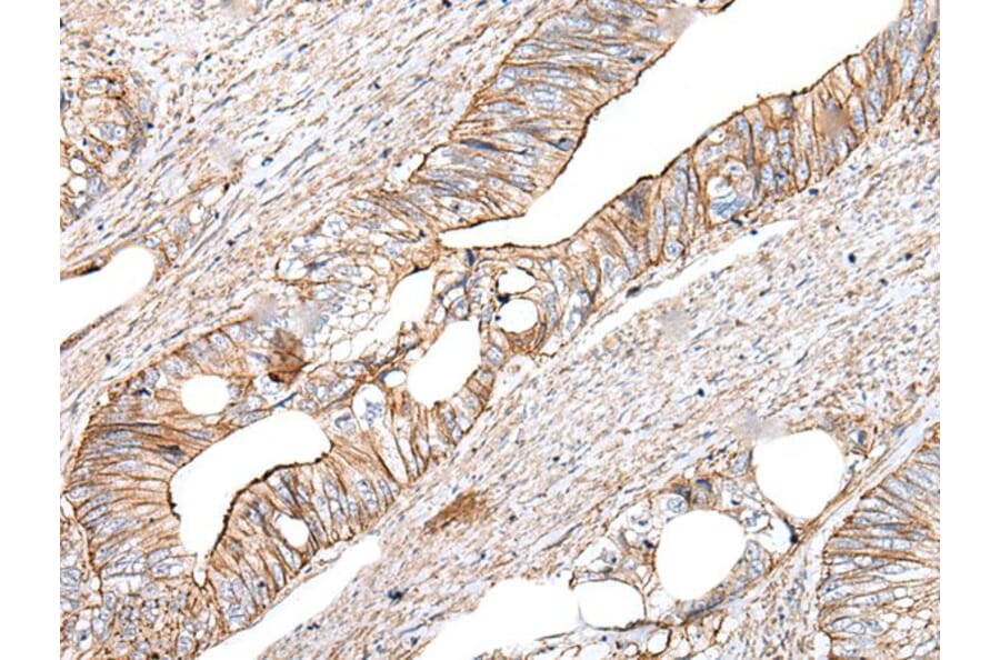 BLVRB Antibody from Signalway Antibody (43993) - Antibodies.com