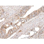 BLVRB Antibody from Signalway Antibody (43993) - Antibodies.com