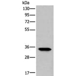LDHC Antibody from Signalway Antibody (43519) - Antibodies.com