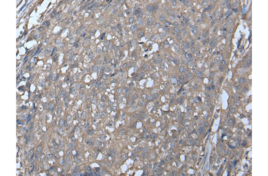 LDHC Antibody from Signalway Antibody (43519) - Antibodies.com