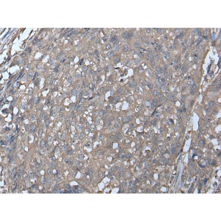 LDHC Antibody from Signalway Antibody (43519) - Antibodies.com