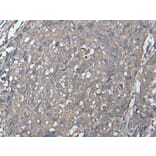 LDHC Antibody from Signalway Antibody (43519) - Antibodies.com