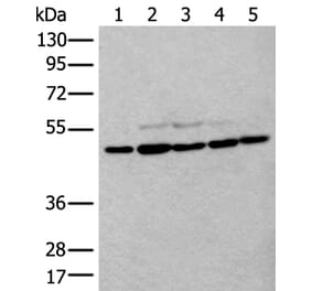 TUBB Antibody from Signalway Antibody (43533) - Antibodies.com