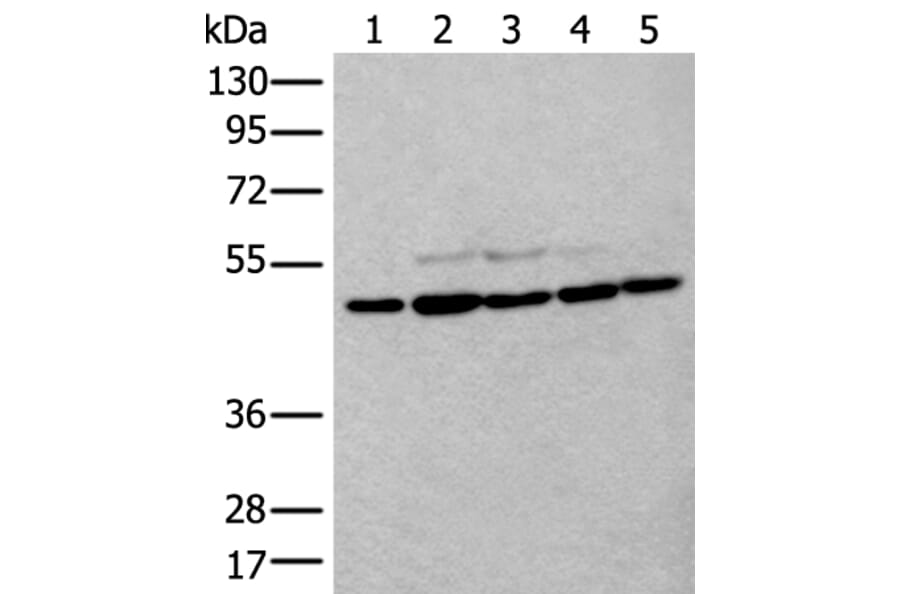 TUBB Antibody from Signalway Antibody (43533) - Antibodies.com