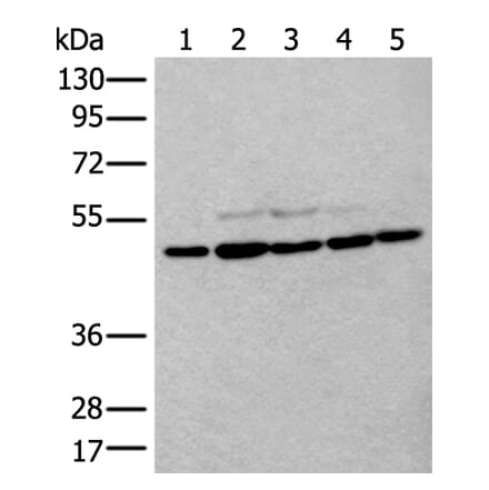 TUBB Antibody from Signalway Antibody (43533) - Antibodies.com