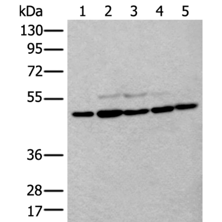TUBB Antibody from Signalway Antibody (43533) - Antibodies.com