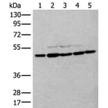 TUBB Antibody from Signalway Antibody (43533) - Antibodies.com