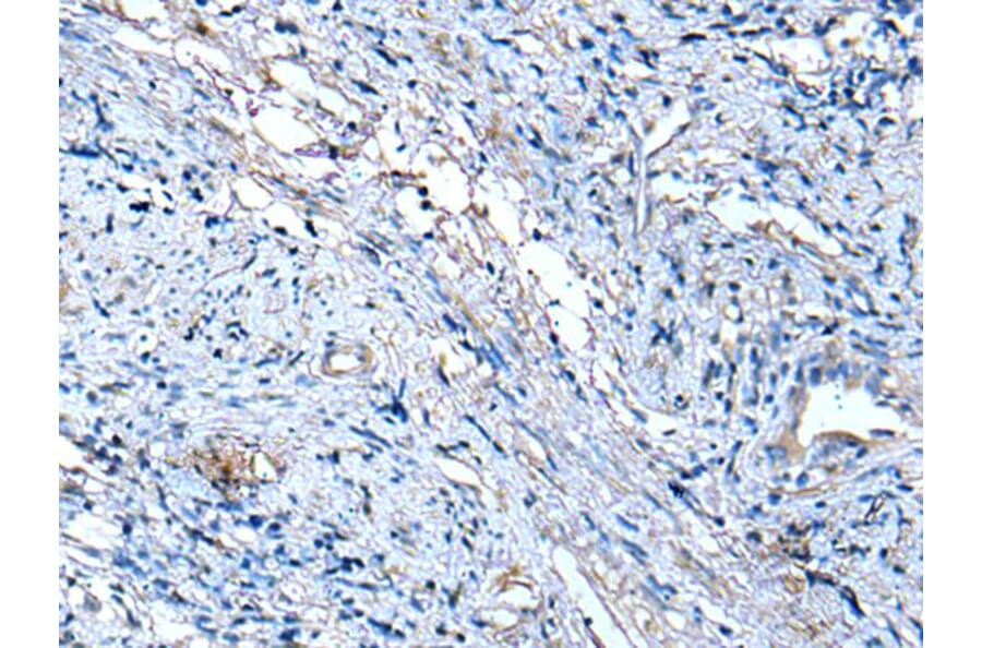 TUBB Antibody from Signalway Antibody (43533) - Antibodies.com