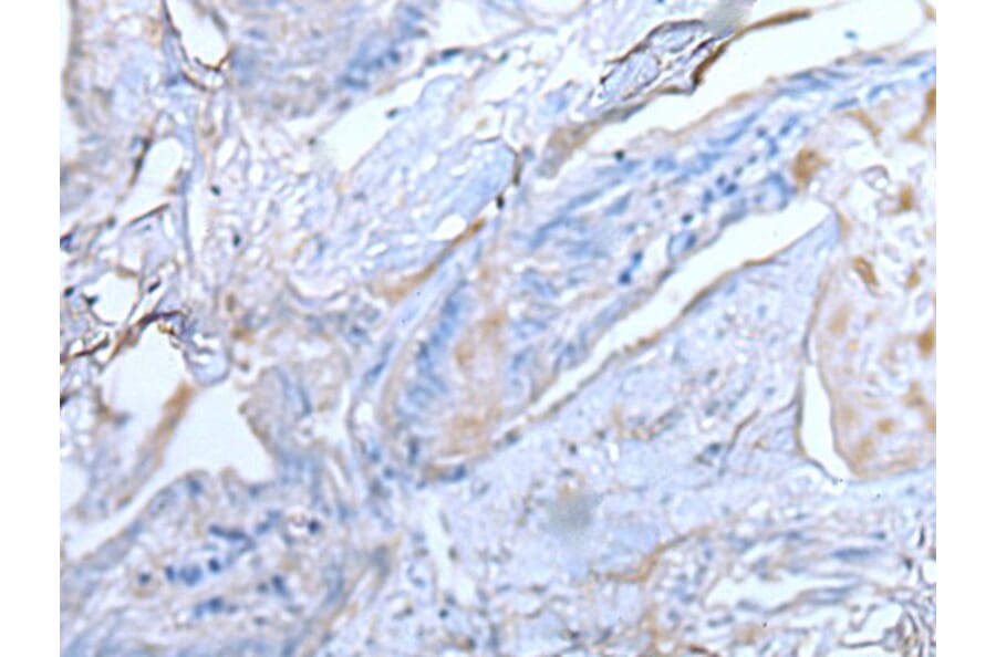 TUBB Antibody from Signalway Antibody (43533) - Antibodies.com