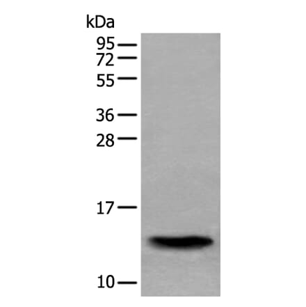 SAA4 Antibody from Signalway Antibody (43534) - Antibodies.com