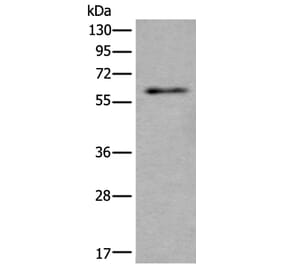SCP2 Antibody from Signalway Antibody (43535) - Antibodies.com