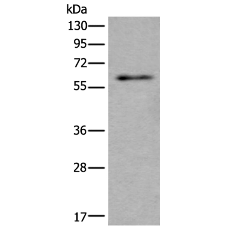 SCP2 Antibody from Signalway Antibody (43535) - Antibodies.com
