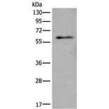SCP2 Antibody from Signalway Antibody (43535) - Antibodies.com