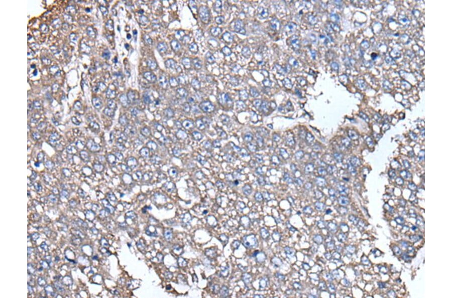 SCP2 Antibody from Signalway Antibody (43535) - Antibodies.com