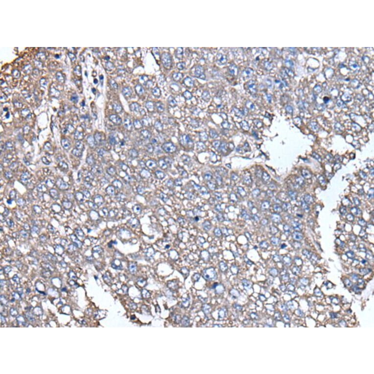 SCP2 Antibody from Signalway Antibody (43535) - Antibodies.com