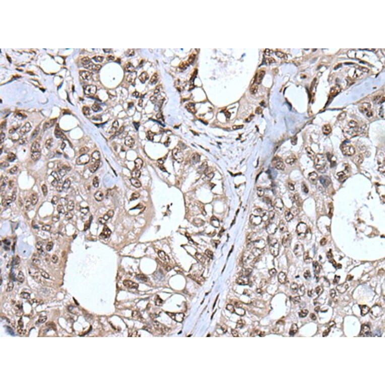 TIA1 Antibody from Signalway Antibody (43541) - Antibodies.com