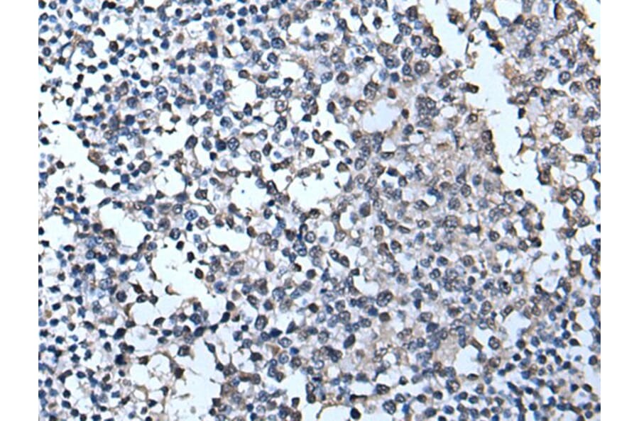 TIA1 Antibody from Signalway Antibody (43541) - Antibodies.com