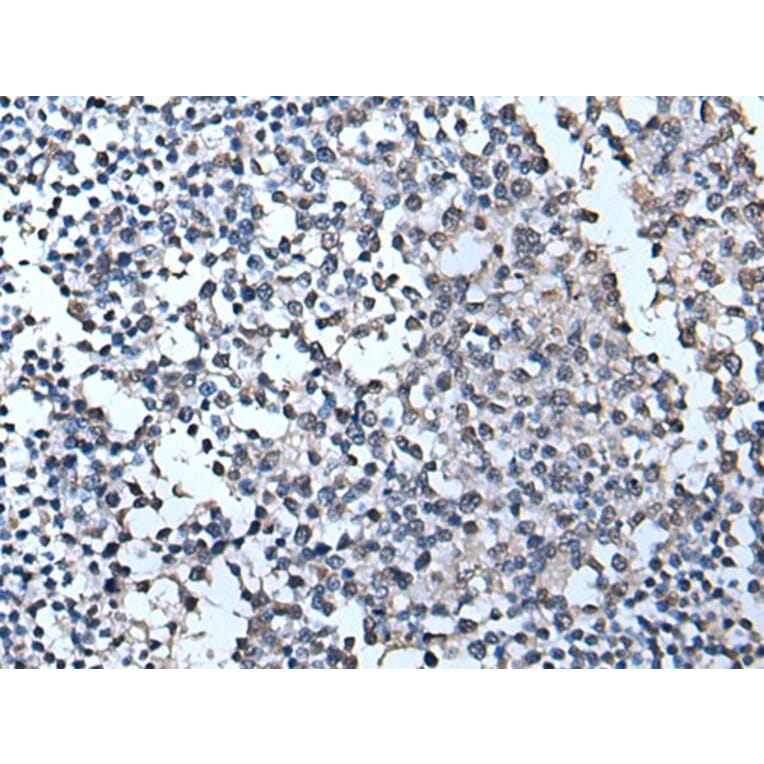 TIA1 Antibody from Signalway Antibody (43541) - Antibodies.com