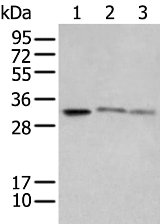 Gel: 12% SDS-PAGE Lysate: 40 &#956;g, Lane 1-3: SP20£¬Raji and Jurkat cell lysates, Primary antibody: SPIC antibody at dilution 1/650, Secondary antibody: Goat anti rabbit IgG at 1/8000 dilution, Exposure time: 10 seconds