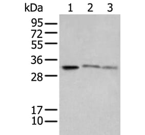 SPIC Antibody from Signalway Antibody (43559) - Antibodies.com