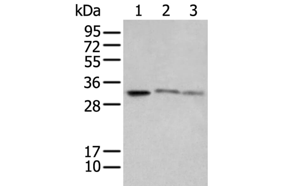 SPIC Antibody from Signalway Antibody (43559) - Antibodies.com